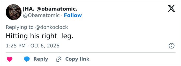 A social media post commenting on Trump's path to Air Force One, mentioning hitting his right leg.